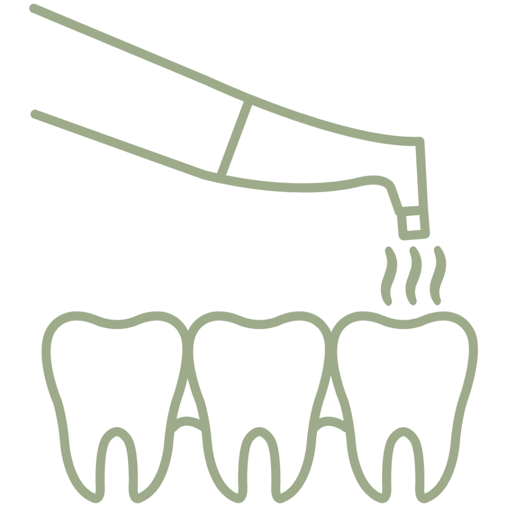 Faccette Dentali 16 Air flow (Igiene orale con micro-polveri)