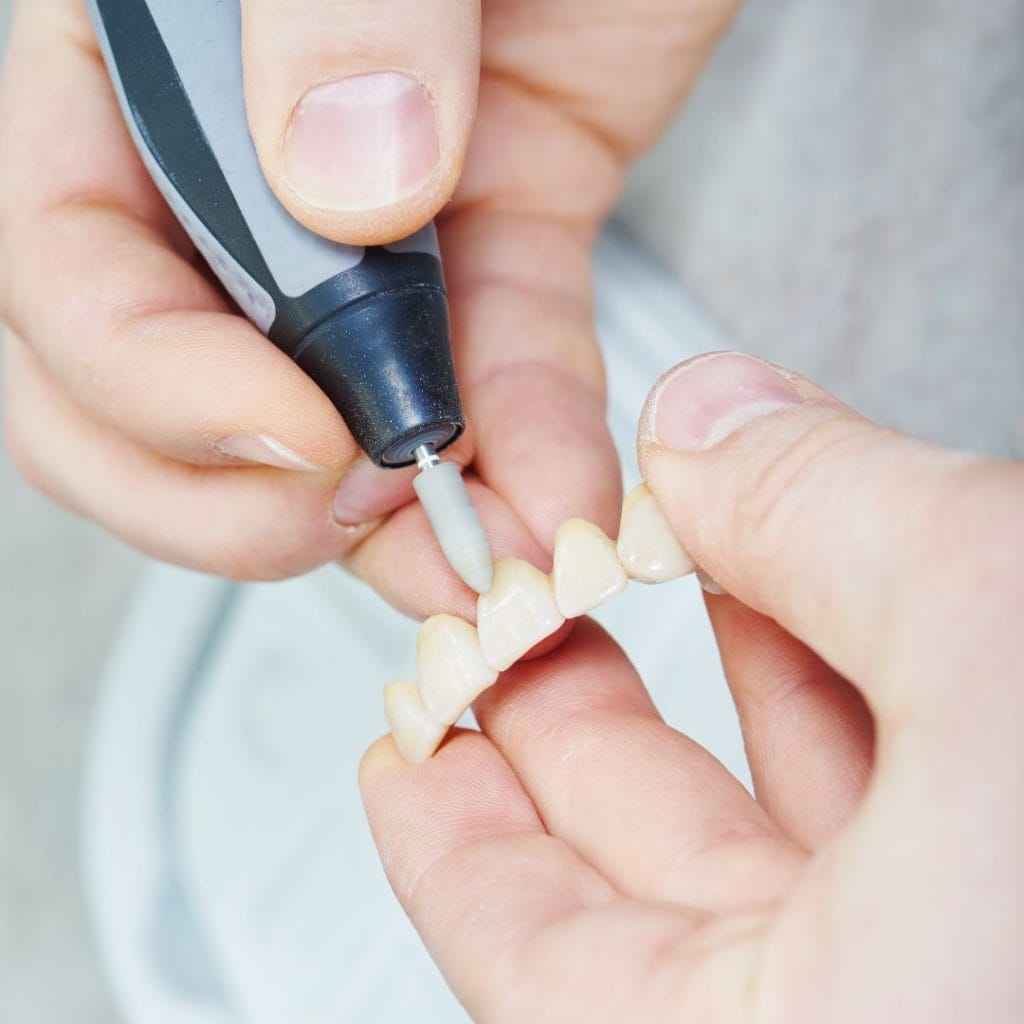 Protesi 1 Dentiera a Vicenza