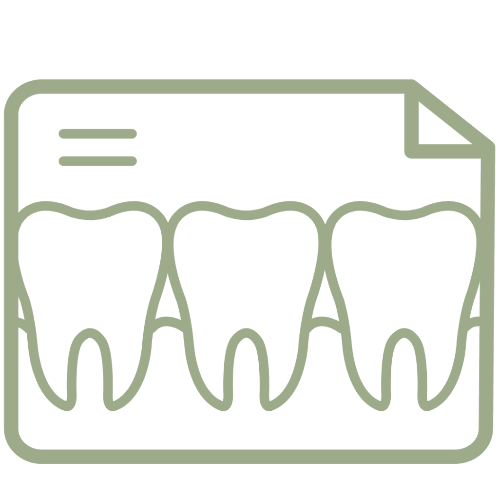 Faccette Dentali 15 Panoramica