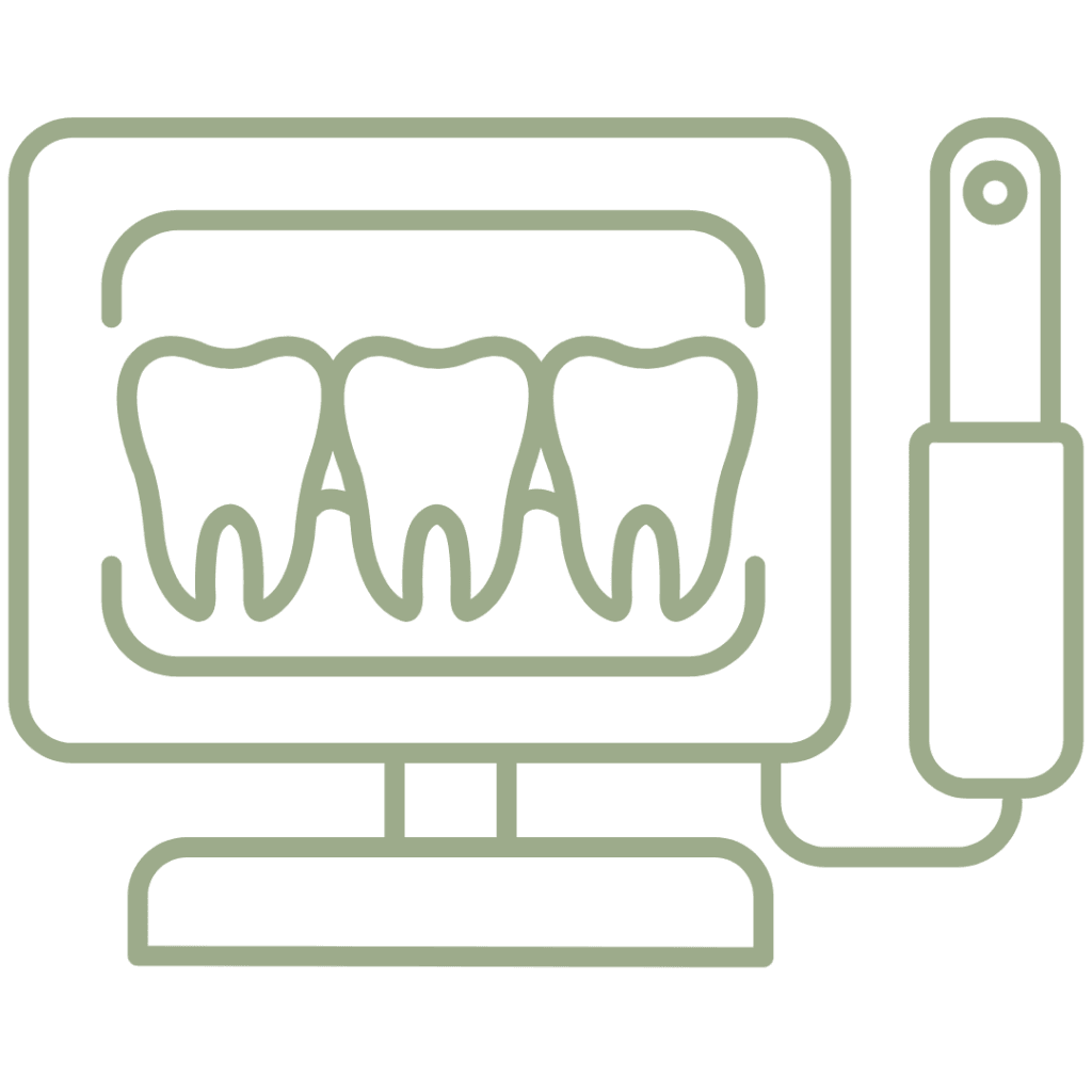 Faccette Dentali 14 Telecamenra intraorale