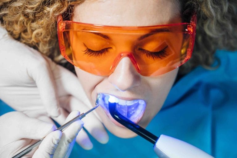 Blog 1 Sbiancamento denti