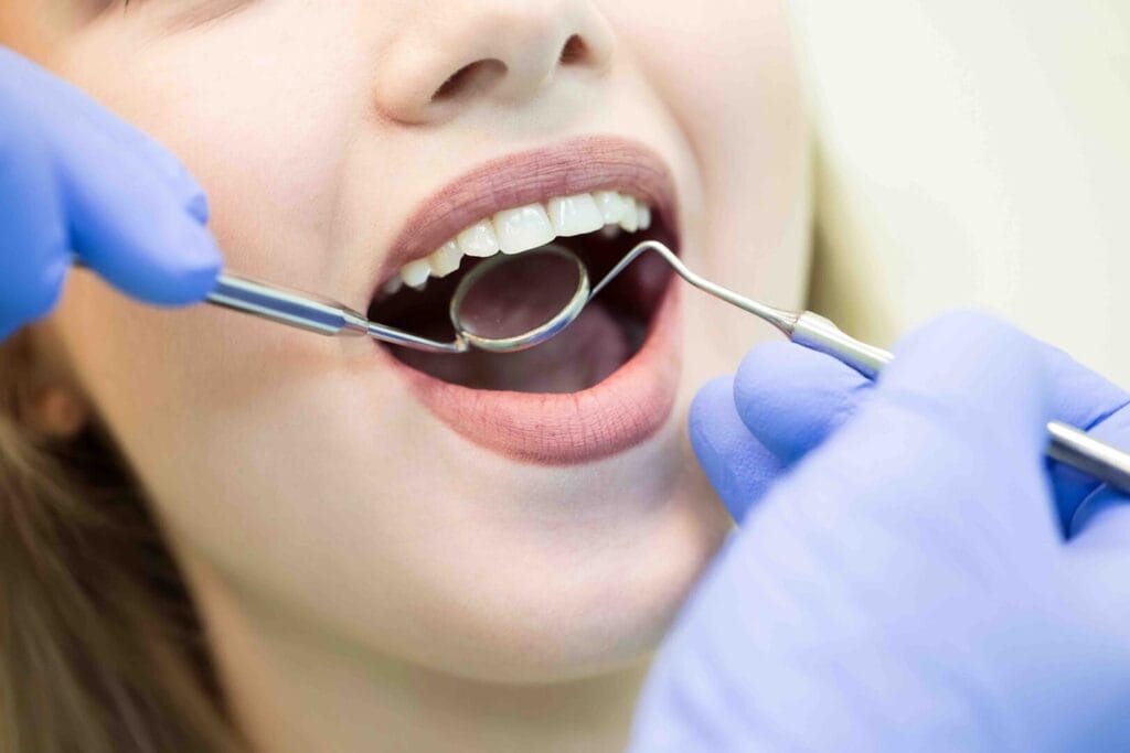 Ogni quanto fare la pulizia dentale 1 Ogni quanto fare la pulizia dentale